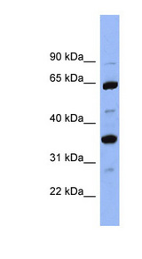 Antithrombin-III Antibody - SERPINC1 / Antithrombin-III antibody Western blot of PANC1 cell lysate. This image was taken for the unconjugated form of this product. Other forms have not been tested.