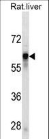 Antithrombin-III Antibody - SERPINC1 Antibody western blot of rat liver tissue lysates (35 ug/lane). The SERPINC1 antibody detected the SERPINC1 protein (arrow).