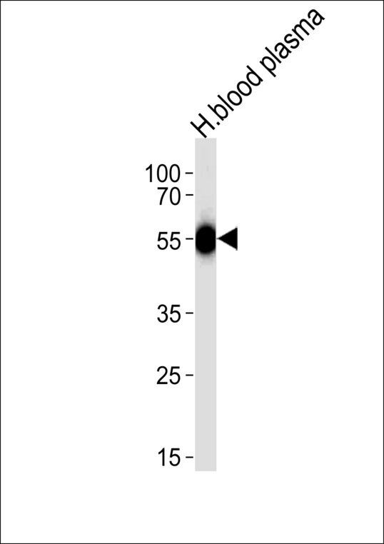 Antithrombin-III Antibody - Western blot of lysate from human blood plasma tissue lysate, using SERPINC1 Antibody. Antibody was diluted at 1:1000 at each lane. A goat anti-rabbit IgG H&L (HRP) at 1:5000 dilution was used as the secondary antibody. Lysate at 35ug per lane.
