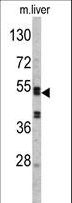 Antithrombin-III Antibody - Western blot of SERPINC1 Antibody in mouse liver tissue lysates (35 ug/lane). SERPINC1 (arrow) was detected using the purified antibody.