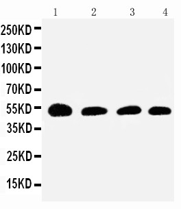 Antithrombin-III Antibody - WB of SERPINC1 / Antithrombin III antibody. Lane 1: Rat Testis Tissue Lysate. Lane 2: SMMC Cell Lysate. Lane 3: JURKAT Cell Lysate. Lane 4: RAJI Cell Lysate.