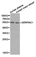 Antithrombin-III Antibody - Western blot of extracts of various cell lines, using SERPINC1 antibody.