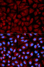 Antithrombin-III Antibody - Immunofluorescence analysis of U2OS cells using SERPINC1 antibody. Blue: DAPI for nuclear staining.