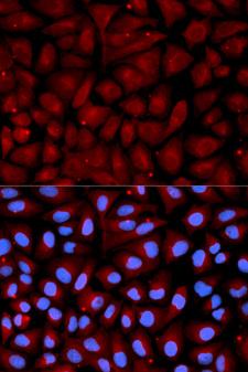 Antithrombin-III Antibody - Immunofluorescence analysis of U2OS cells using SERPINC1 antibody. Blue: DAPI for nuclear staining.