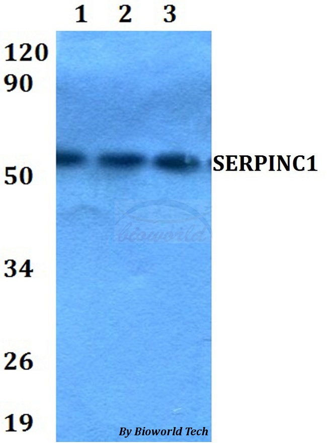 Antithrombin-III Antibody - Western blot of SERPINC1 antibody at 1:500 dilution. Lane 1: HEK293T whole cell lysate. Lane 2: Raw264.7 whole cell lysate. Lane 3: PC12 whole cell lysate.