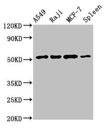 Antithrombin-III Antibody - Western Blot Positive WB detected in:A549 whole cell lysate,Raji whole cell lysate,MCF-7 whole cell lysate,Rat spleen tissue All Lanes:SERPINC1 antibody at 2.5µg/ml Secondary Goat polyclonal to rabbit IgG at 1/50000 dilution Predicted band size: 53 KDa Observed band size: 53 KDa