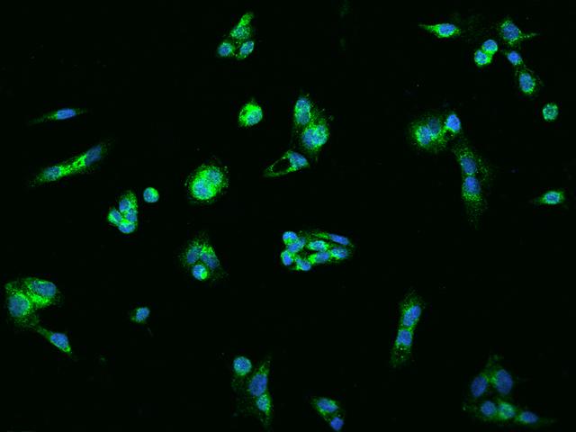 Antithrombin-III Antibody - Immunofluorescence staining of SERPINC1 in HepG2 cells. Cells were fixed with 4% PFA, permeabilzed with 0.1% Triton X-100 in PBS, blocked with 10% serum, and incubated with rabbit anti-Human SERPINC1 polyclonal antibody (dilution ratio 1:200) at 4°C overnight. Then cells were stained with the Alexa Fluor 488-conjugated Goat Anti-rabbit IgG secondary antibody (green) and counterstained with DAPI (blue). Positive staining was localized to Cytoplasm.