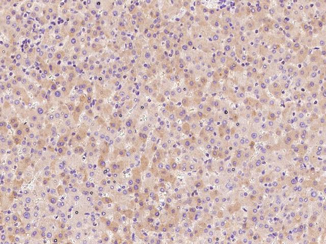 Antithrombin-III Antibody - Immunochemical staining of human SERPINC1 in human liver with rabbit polyclonal antibody at 1:500 dilution, formalin-fixed paraffin embedded sections.