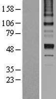 Antithrombin-III Protein - Western validation with an anti-DDK antibody * L: Control HEK293 lysate R: Over-expression lysate