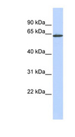 ANTXR1 / TEM8 Antibody - ANTXR1 / TEM8 antibody Western blot of MCF7 cell lysate. This image was taken for the unconjugated form of this product. Other forms have not been tested.