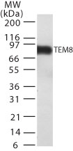 ANTXR1 / TEM8 Antibody - Western blot detection of TEM8 in TEM8 transfected cell lysate using antibody at 1 ug/ml.