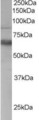 ANTXR1 / TEM8 Antibody - Antibody staining (0.3 ug/ml) of Human PBMC lysate (RIPA buffer, 35 ug total protein per lane). Primary incubated for 1 hour. Detected by Western blot of chemiluminescence.