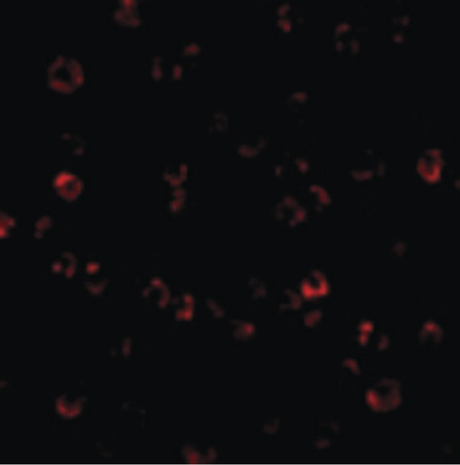 ANTXR1 / TEM8 Antibody - Immunofluorescence of ATR in K562 cells with ATR antibody at 10 ug/ml.
