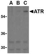 ANTXR1 / TEM8 Antibody - Western blot of ATR in K562 cell lysates with ATR antibody at (A) 0.5, (B) 1, and (C) 2 ug/ml.
