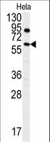ANTXR1 / TEM8 Antibody - Western blot of anti-ANTXR1 Antibody (Y382) in HeLa cell line lysates (35 ug/lane). ANTXR1 (arrow) was detected using the purified antibody.
