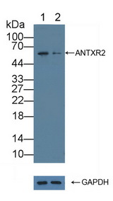 ANTXR2 / CMG2 Antibody - Knockout Varification: Lane 1: Wild-type PC3 cell lysate; Lane 2: ANTXR2 knockout PC3 cell lysate; Predicted MW: 54,53,43,35kd Observed MW: 58kd Primary Ab: 1µg/ml Rabbit Anti-Human ANTXR2 Antibody Second Ab: 0.2µg/mL HRP-Linked Caprine Anti-Rabbit IgG Polyclonal Antibody