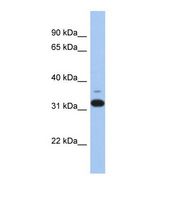 ANTXR2 / CMG2 Antibody - Western blot of Human DU145. ANTXR2 antibody dilution 1.0 ug/ml.  This image was taken for the unconjugated form of this product. Other forms have not been tested.