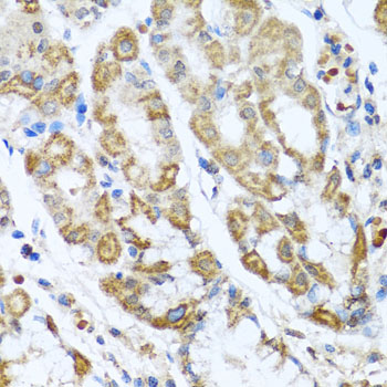 ANTXR2 / CMG2 Antibody - Immunohistochemistry of paraffin-embedded human gastric using ANTXR2 antibody at dilution of 1:100 (x40 lens).
