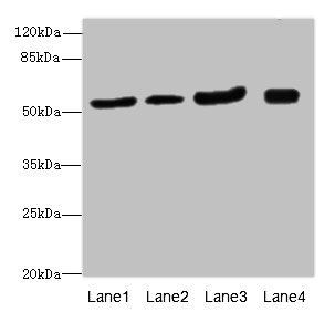 ANTXR2 / CMG2 Antibody - Western blot All Lanes: ANTXR2antibody at 1.24ug/ml Lane 1 : Mouse lung tissue Lane 2 : Mouse gonadal tissue Lane 3 : Mouse kidney tissue Lane 4 : Mouse small intestine tissue Secondary Goat polyclonal to Rabbit IgG at 1/10000 dilution Predicted band size: 54,43,35 kDa Observed band size: 54 kDa
