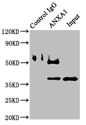 ANXA1 / Annexin A1 Antibody - Immunoprecipitating ANXA1 in K562 whole cell lysate Lane 1: Rabbit control IgG instead of ANXA1 Antibody in K562 whole cell lysate.For western blotting, a HRP-conjugated Protein G antibody was used as the secondary antibody (1/2000) Lane 2: ANXA1 Antibody (8µg) + K562 whole cell lysate (500µg) Lane 3: K562 whole cell lysate (10µg)