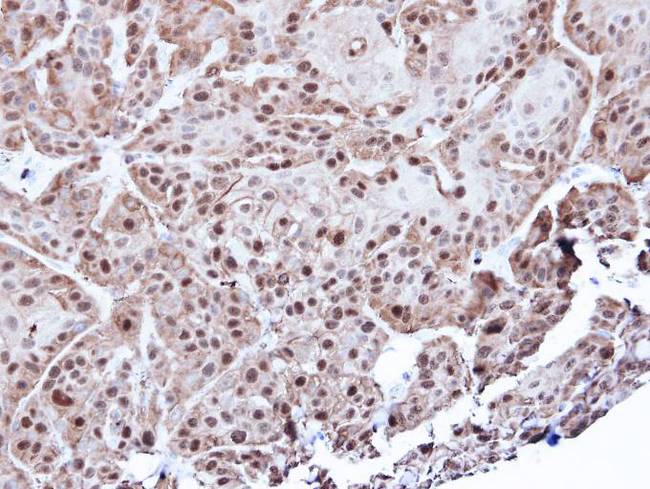 ANXA1 / Annexin A1 Antibody - IHC of paraffin-embedded Cal27 xenograft using Annexin A1 antibody at 1:500 dilution.