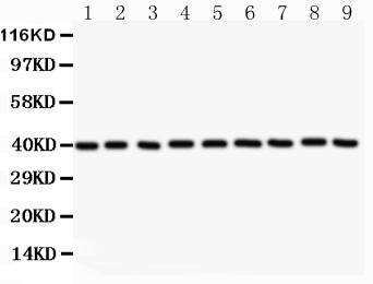 ANXA1 / Annexin A1 Antibody - Anti-Annexin A1 Picoband antibody, All lanes: Anti AnnexinA1 at 0.5ug/ml Lane 1: HEPG2 Whole Cell Lysate at 40ugLane 2: MCF-7 Whole Cell Lysate at 40ugLane 3: U87 Whole Cell Lysate at 40ugLane 4: PANC Whole Cell Lysate at 40ug Lane 5: SMMC Whole Cell Lysate at 40ug Lane 6: SW620 Whole Cell Lysate at 40ug Lane 7: COLO320 Whole Cell Lysate at 40ug Lane 8: A549 Whole Cell Lysate at 40ug Lane 9: JURKAT Whole Cell Lysate at 40ug Predicted bind size: 39KD Observed bind size: 39KD