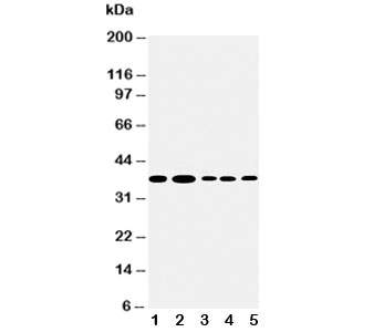 ANXA1 / Annexin A1 Antibody - Western blot testing of Annexin A1 antibody and Lane 1: U87; 2: HeLa; 3: PANC; 4: COLO320; 5: SMMC-7721 cell lysate