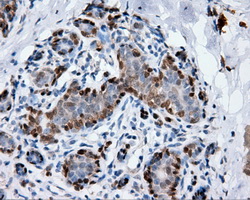 ANXA1 / Annexin A1 Antibody - IHC of paraffin-embedded breast tissue using anti-ANXA1 mouse monoclonal antibody. (Dilution 1:50).