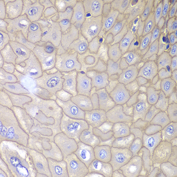 ANXA1 / Annexin A1 Antibody - Immunohistochemistry of paraffin-embedded human esophageal tissue.