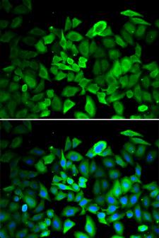 ANXA1 / Annexin A1 Antibody - Immunofluorescence analysis of HeLa cells.