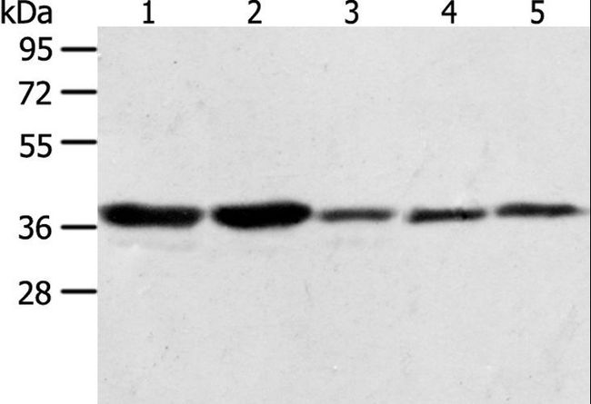 ANXA1 / Annexin A1 Antibody - Western blot analysis of A431, NIH/3T3, HeLa, Jurkat and PC3 cell, using ANXA1 Polyclonal Antibody at dilution of 1:400.