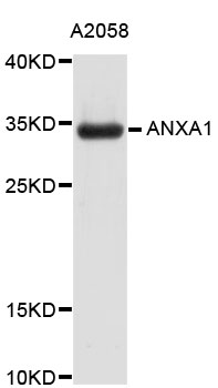 ANXA1 / Annexin A1 Antibody - Western blot analysis of extracts of A2058 cells, using ANXA1 antibody. The secondary antibody used was an HRP Goat Anti-Rabbit IgG (H+L) at 1:10000 dilution. Lysates were loaded 25ug per lane and 3% nonfat dry milk in TBST was used for blocking.