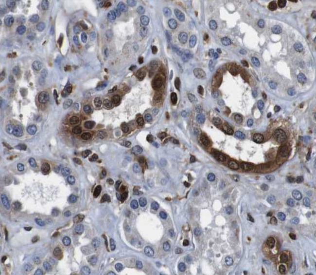 ANXA1 / Annexin A1 Antibody - IHC analysis of Annexin I expression in COLO.