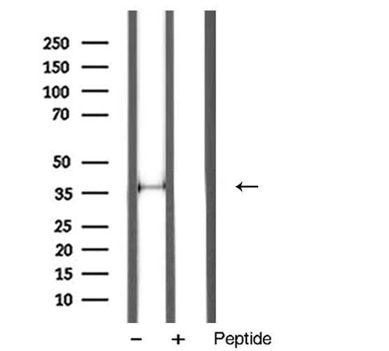 ANXA1 / Annexin A1 Antibody - Western blot analysis of Annexin I antibody expression in mouse liver tissue lysates. The lane on the right is treated with the antigen-specific peptide.