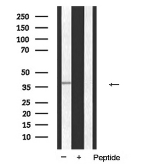 ANXA1 / Annexin A1 Antibody - Western blot analysis of ANXA1 expression in K562 cells