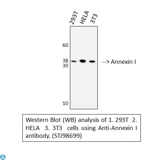 ANXA1 / Annexin A1 Antibody - Immunohistochemical analysis of paraffin-embedded human-brain, antibody was diluted at 1:200.