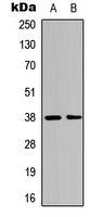 ANXA1 / Annexin A1 Antibody - Western blot analysis of Annexin A1 (pY21) expression in A431 (A); NIH3T3 (B) whole cell lysates.