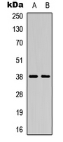 ANXA1 / Annexin A1 Antibody - Western blot analysis of Annexin A1 expression in A549 (A); HeLa (B) whole cell lysates.