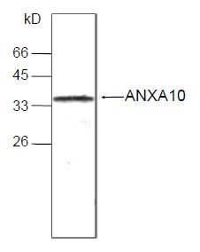 ANXA10 / Annexin A10 Antibody