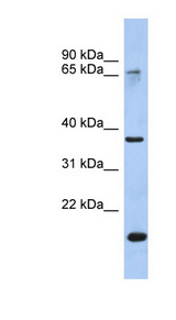 ANXA10 / Annexin A10 Antibody - ANXA10 / Annexin A10 antibody Western blot of ACHN lysate. This image was taken for the unconjugated form of this product. Other forms have not been tested.