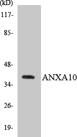 ANXA10 / Annexin A10 Antibody - Western blot analysis of the lysates from Jurkat cells using ANXA10 antibody.