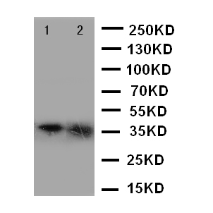 ANXA10 / Annexin A10 Antibody - WB of ANXA10 / Annexin A10 antibody. Lane 1: A549 Cell Lysate. Lane 2: A549 Cell Lysate.