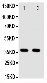ANXA10 / Annexin A10 Antibody - Anti-Annexin A10 antibody, Western blotting Lane 1: A549 Cell LysateLane 2: A549 Cell Lysate
