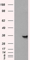 ANXA10 / Annexin A10 Antibody - HEK293T cells were transfected with the pCMV6-ENTRY control (Left lane) or pCMV6-ENTRY ANXA10 (Right lane) cDNA for 48 hrs and lysed. Equivalent amounts of cell lysates (5 ug per lane) were separated by SDS-PAGE and immunoblotted with anti-ANXA10.