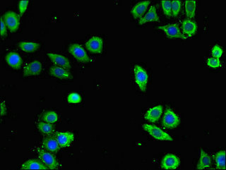 ANXA10 / Annexin A10 Antibody - Immunofluorescent analysis of PC-3 cells using ANXA10 Antibody at dilution of 1:100 and Alexa Fluor 488-congugated AffiniPure Goat Anti-Rabbit IgG(H+L)