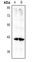ANXA10 / Annexin A10 Antibody - Western blot analysis of Annexin A10 expression in SGC7901 (A), LO2 (B) whole cell lysates.