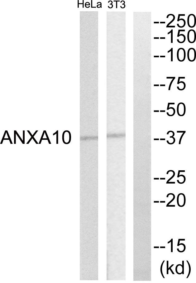 ANXA10 / Annexin A10 Antibody - Western blot analysis of extracts from HeLa cell and NIH-3T3 cells, using ANXA10 antibody.
