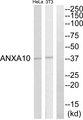 ANXA10 / Annexin A10 Antibody - Western blot analysis of extracts from HeLa cell and NIH-3T3 cells, using ANXA10 antibody.