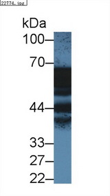 ANXA11 / Annexin XI Antibody - Western Blot; Sample: Human A431 cell lysate; Primary Ab: 1µg/ml Rabbit Anti-Human ANXA11 Antibody Second Ab: 0.2µg/mL HRP-Linked Caprine Anti-Rabbit IgG Polyclonal Antibody