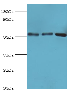 ANXA11 / Annexin XI Antibody - Western blot. All lanes: Annexin A11 antibody at 14 ug/ml. Lane 1: HeLa whole cell lysate. Lane 2: A431 whole cell lysate. Lane 3: U251 whole cell lysate. secondary Goat polyclonal to rabbit at 1:10000 dilution. Predicted band size: 54 kDa. Observed band size: 54 kDa.